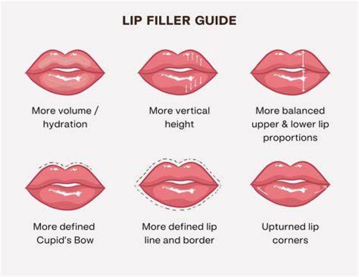 What is the least amount of lip filler you can get?