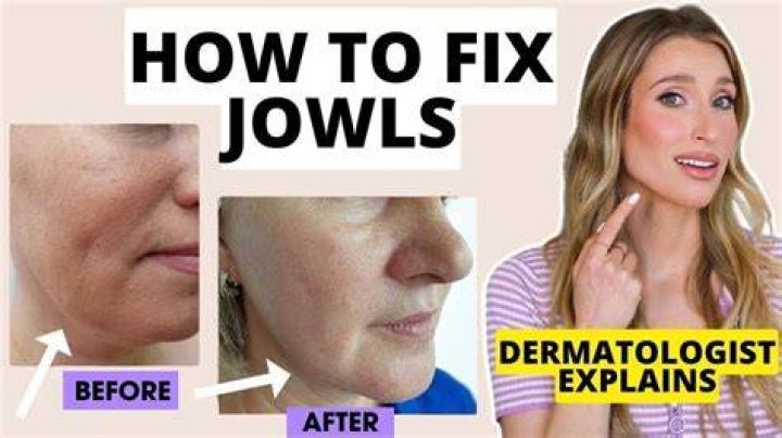 What is the meaning of jowly?