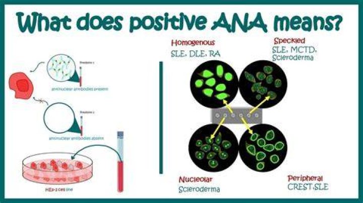 What is the next step after a positive ANA test?