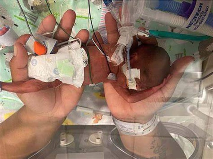 What is the youngest baby to survive?