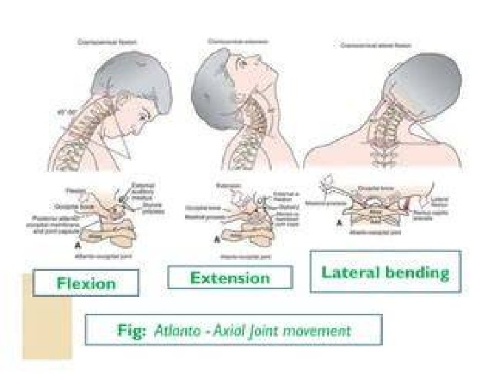 What joint allows you to shake your head no?