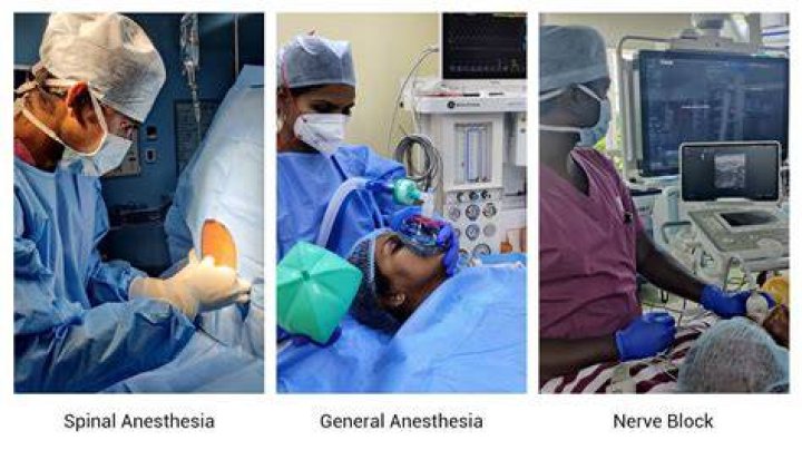 What kind of anesthesia is used for endoscopy?
