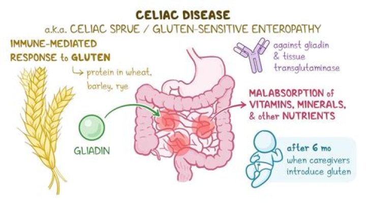 What part of the body does celiac disease affect?