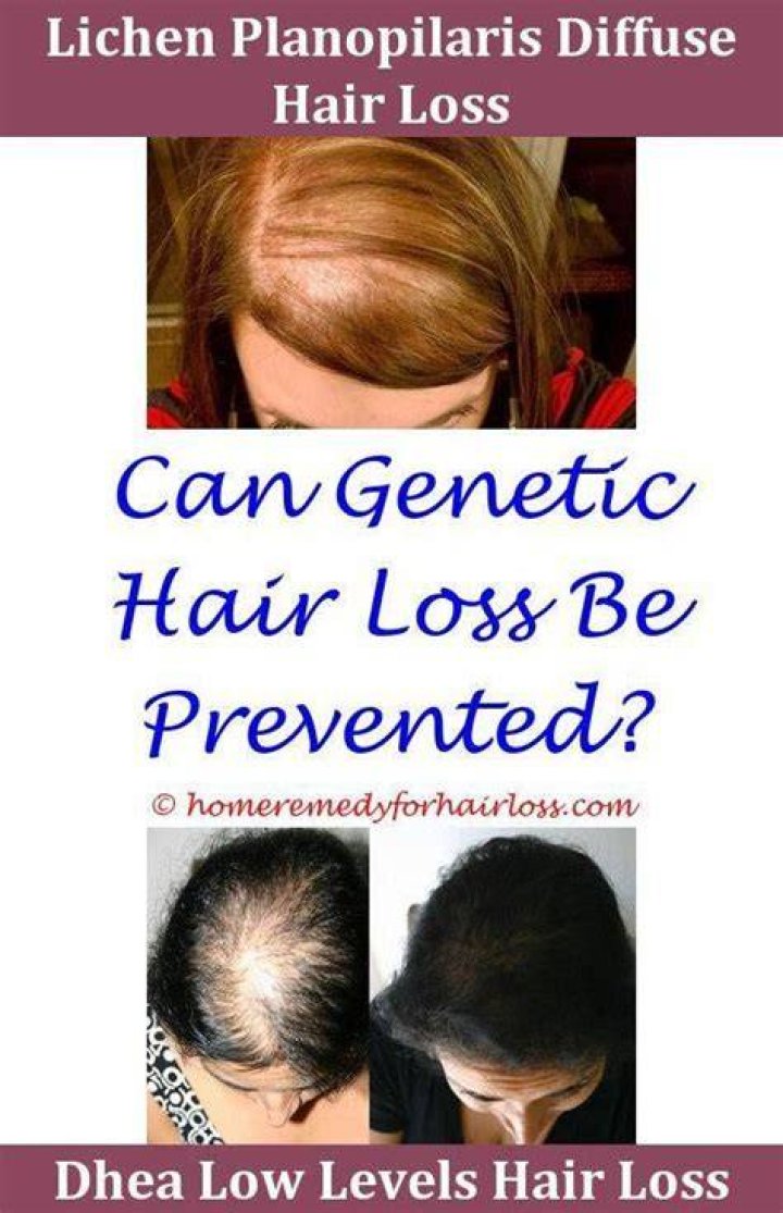 What would a dermatologist prescribe for hair loss?