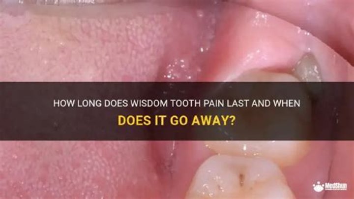 When does wisdom tooth pain go away?