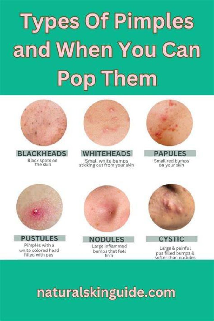 When I pop a pimple something hard comes out?