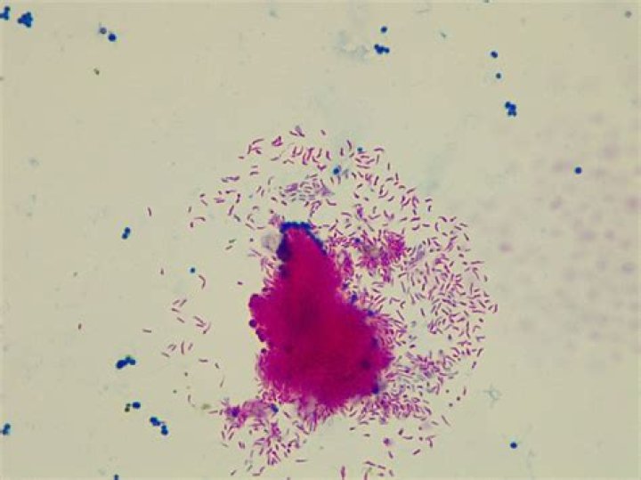 Where is Mycobacterium Phlei found?