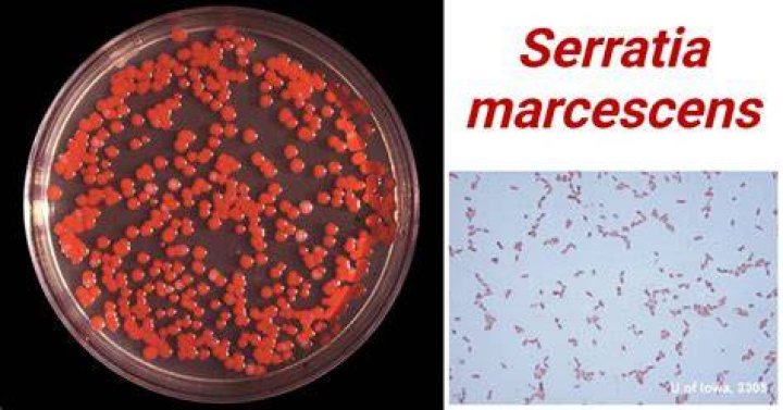 Where is Serratia marcescens normally found?