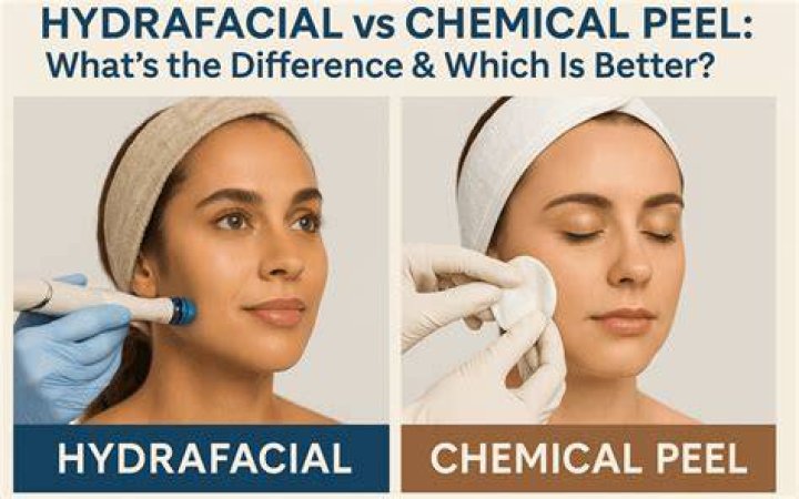 Which is better HydraFacial or chemical peel?