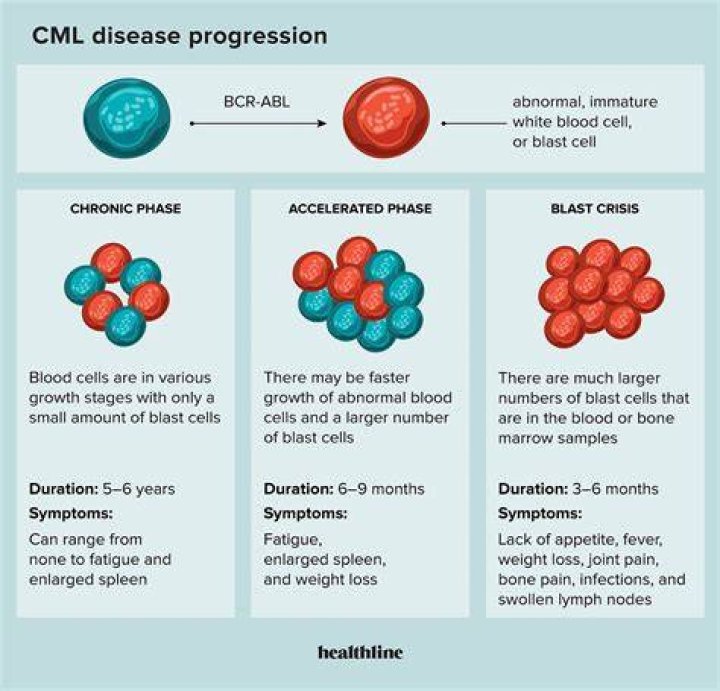 Which is worse all or AML?