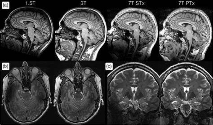 Who has a 7 tesla MRI?