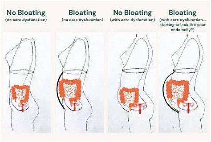 Why can I push my stomach out and look pregnant?