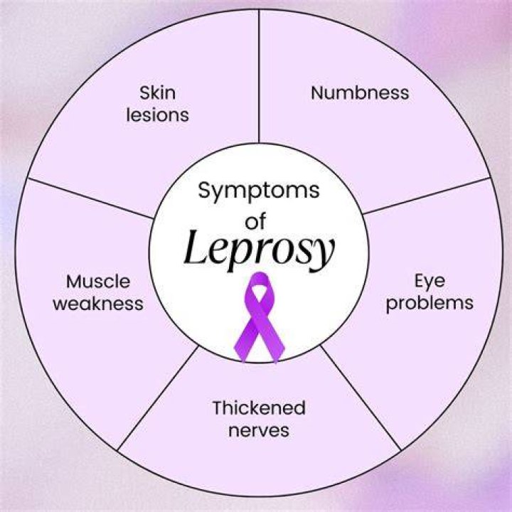 Why did leprosy decline in Europe?