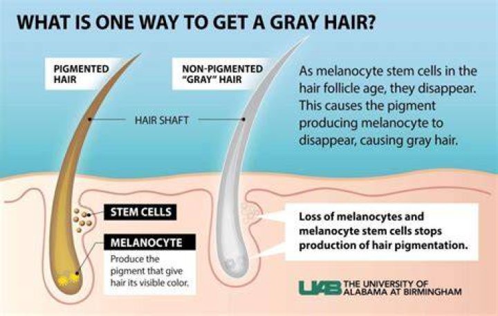 Why do I have grey hair at 14?