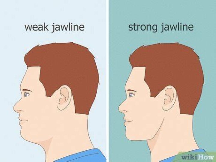 Why do I have no jawline?