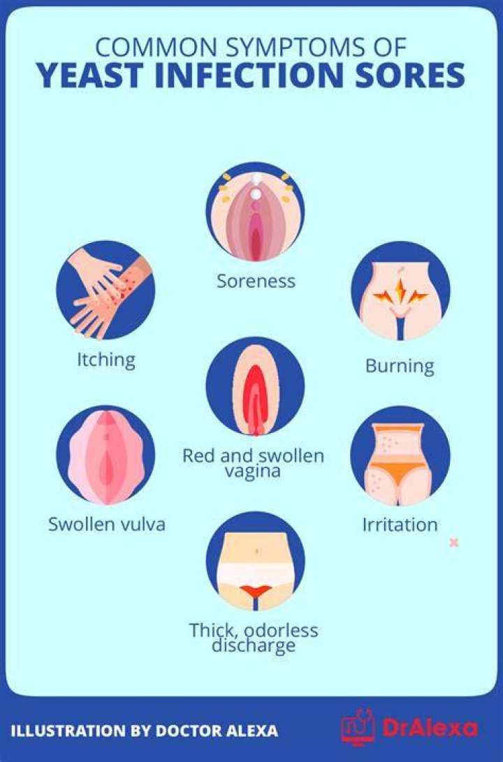 Why do I keep getting yeast infections on my skin?