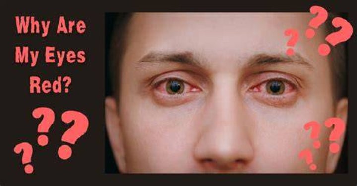 Why do I turn red when I see my crush?