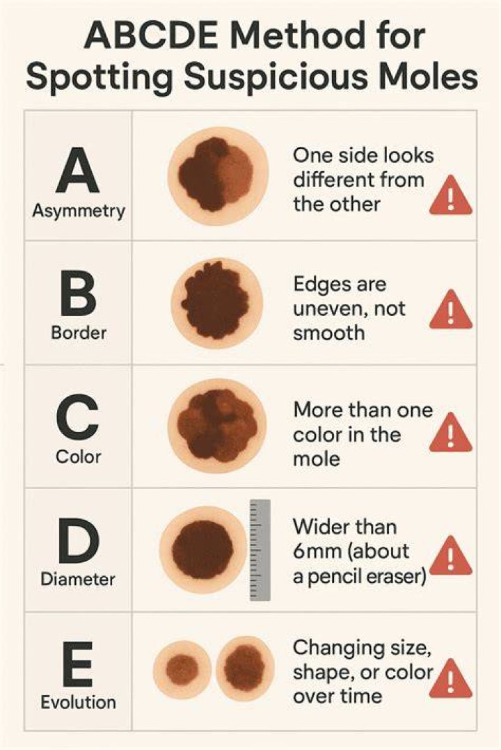 Why do we get moles as we age?