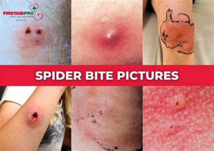 Why do we scream when we see a spider?
