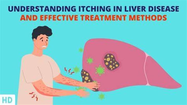 Why do you itch with liver disease?