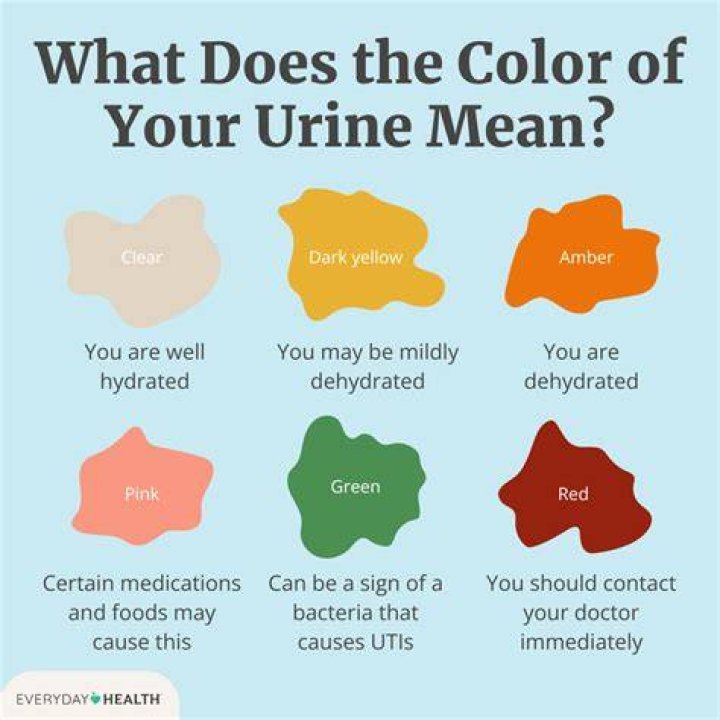 Why does my pee smell like eggs?