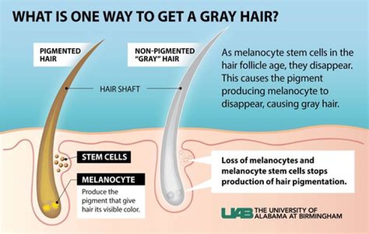 Why is my hair going grey so fast?