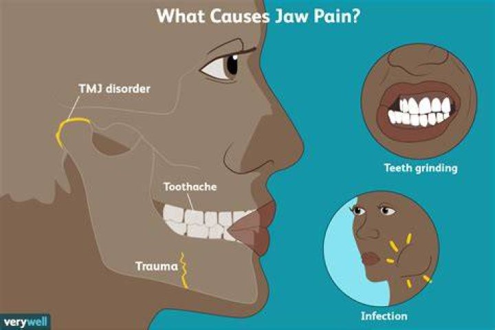 Why is my TMJ getting worse?