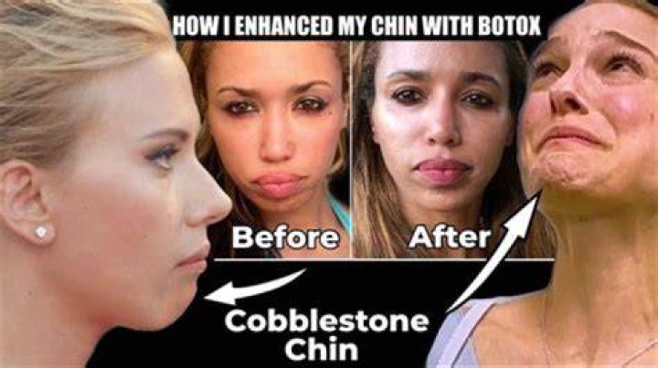 Why is Thanos chin weird?