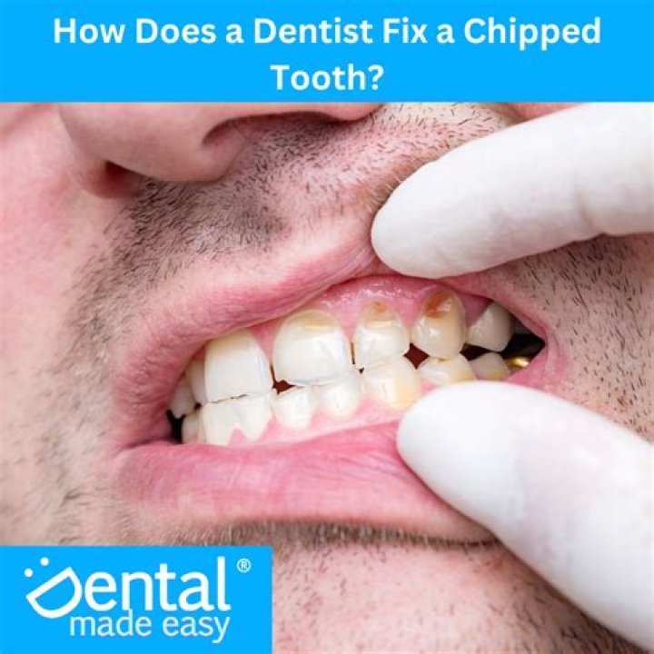 Will a chipped tooth get worse?