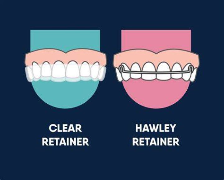 Will I get a clear retainer after braces?
