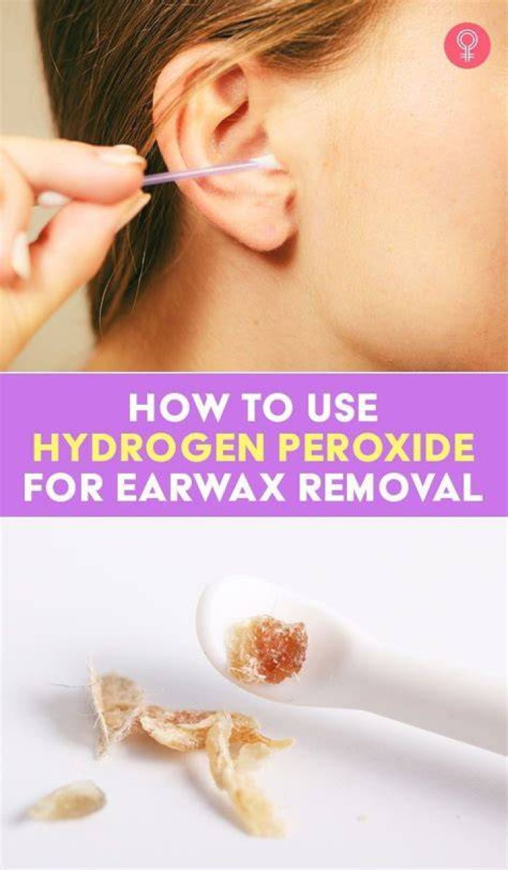 Will peroxide get a bug out of your ear?